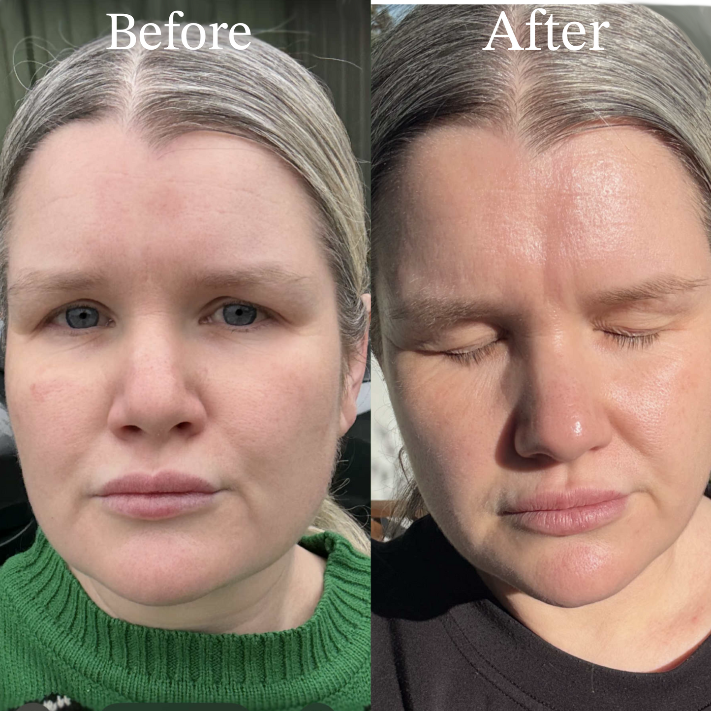 TSII Premium Hybrid Mask (LED + Laser) – Advanced Edition