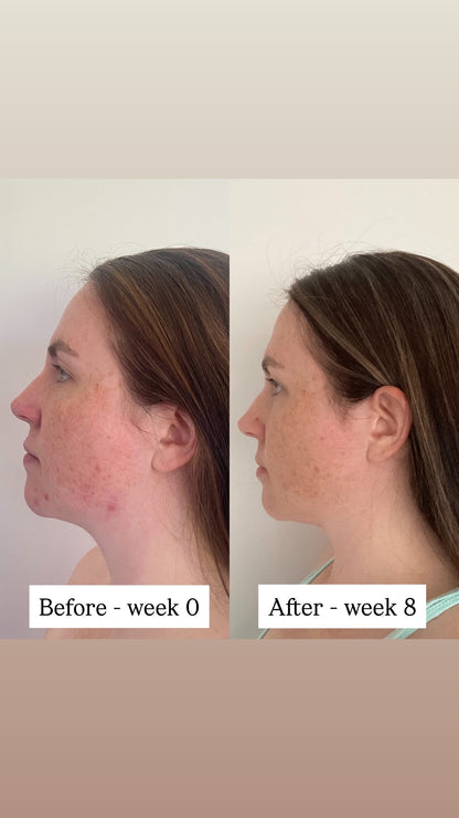 TSII Premium LED Mask - Face + Neck