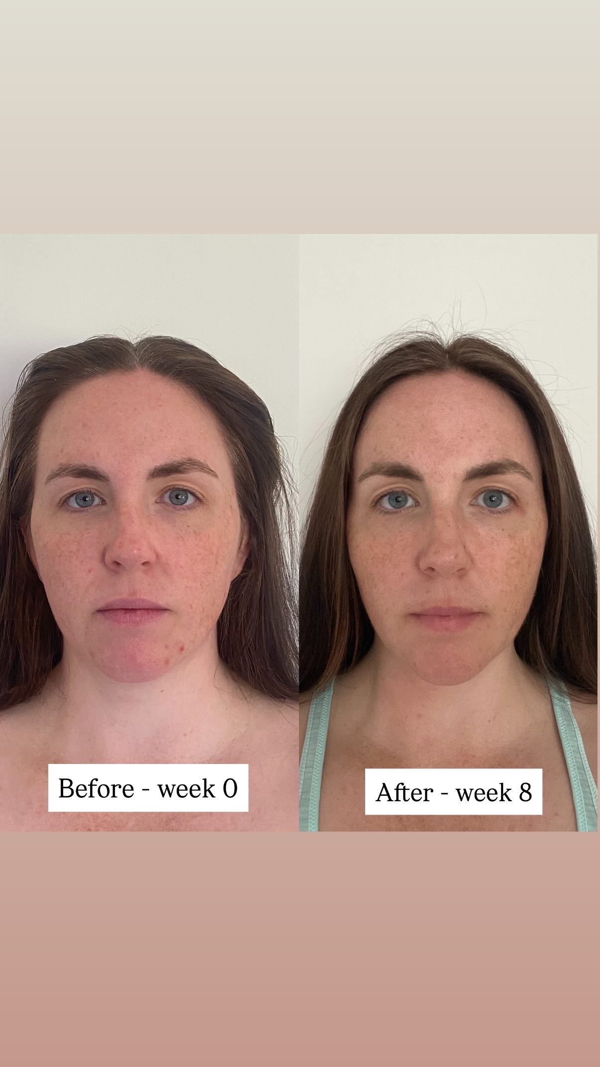 TSII Premium LED Mask - Face + Neck