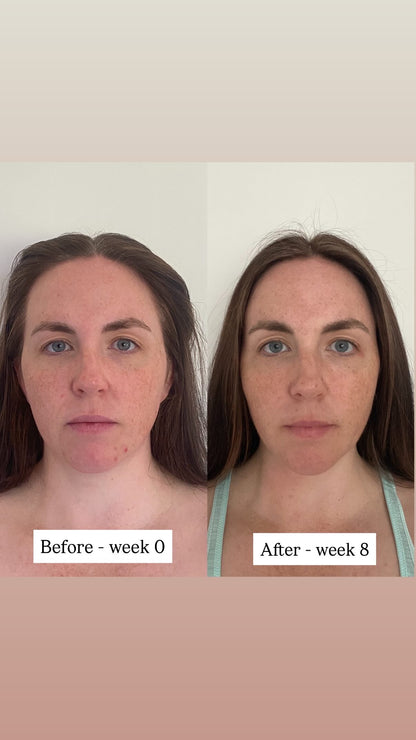 TSII Premium LED Mask - Face + Neck