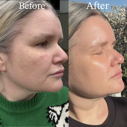 TSII Premium Hybrid Mask (LED + Laser) – Advanced Edition