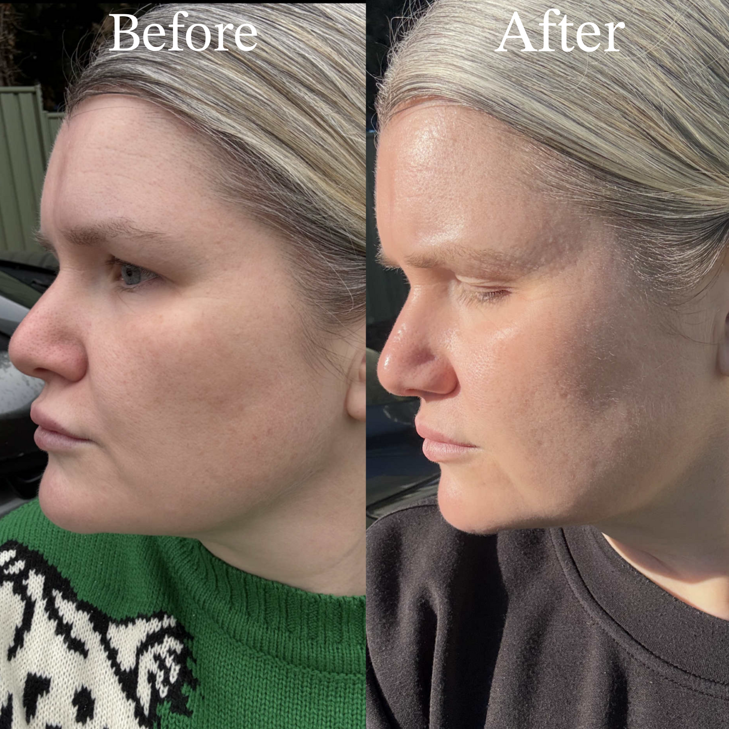 TSII Premium Hybrid Mask (LED + Laser) – Advanced Edition